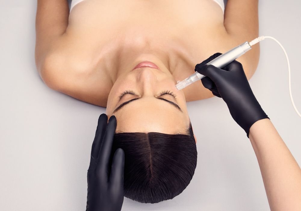 Microneedling Behandlung mit DOCTOR BABOR PRO im Kosmetikstudio